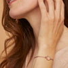 Catch armband